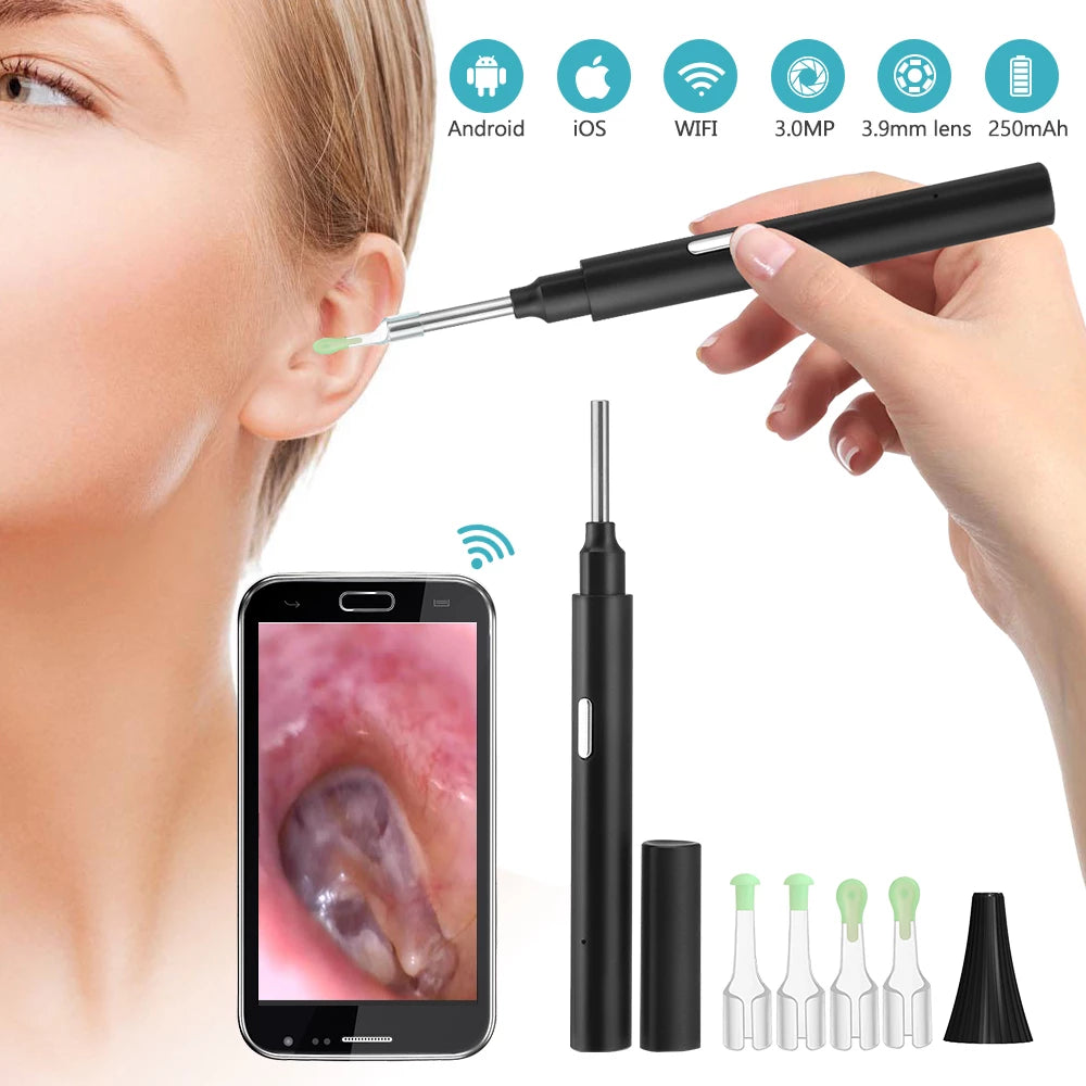 Wireless Smart Video Ear Wax Remover