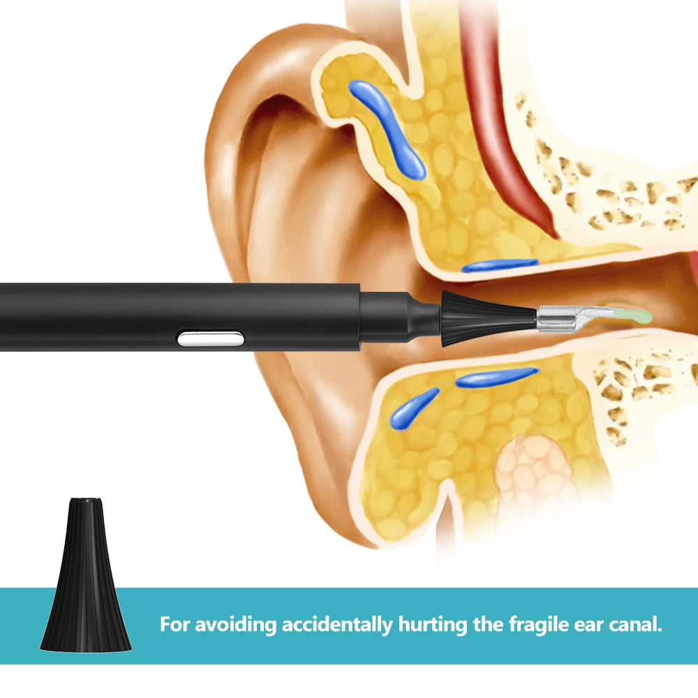 Wireless Smart Video Ear Wax Remover